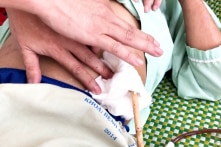 Xuất hiện khối áp-xe lớn trong ổ bụng, 2 tháng sau bệnh nhân mới biết bị mắc bệnh Whitmore