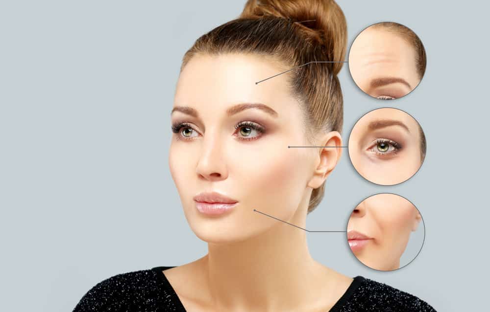 vị trí tiêm botox