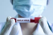 Phát hiện: Virus Ebola có thể “ẩn mình” 5-6 năm trong cơ thể bệnh nhân đã khỏi bệnh