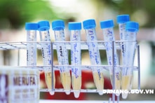 Sáng 13/5: Thêm 35 ca mắc COVID-19; riêng Đà Nẵng chiếm đến 22 ca