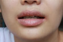 10 dấu hiệu cho thấy bạn đang không uống đủ nước