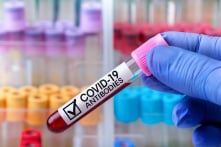 Phát hiện siêu kháng thể vô hiệu hóa mọi biến thể đáng lo ngại của virus corona