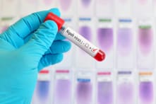 Lý do mà thế giới nên cảnh giác với virus Nipah