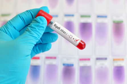 Lý do mà thế giới nên cảnh giác với virus Nipah