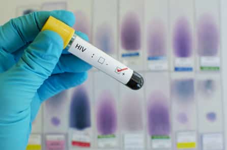 Các nhà khoa học Mỹ phát triển phương pháp tiêu diệt virus HIV tiềm ẩn trong tế bào