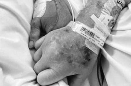 Vợ chồng già nhiễm Covid nắm tay nhau phút lâm chung: “Bên nhau mãi không rời”’