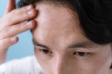 Mồ hôi nói gì về sức khỏe của bạn?