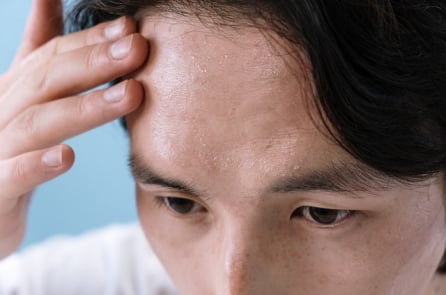 Mồ hôi nói gì về sức khỏe của bạn?