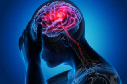 Hậu COVID-19: Nghiên cứu mới phát hiện virus gây tổn thương não giống bệnh Alzheimer