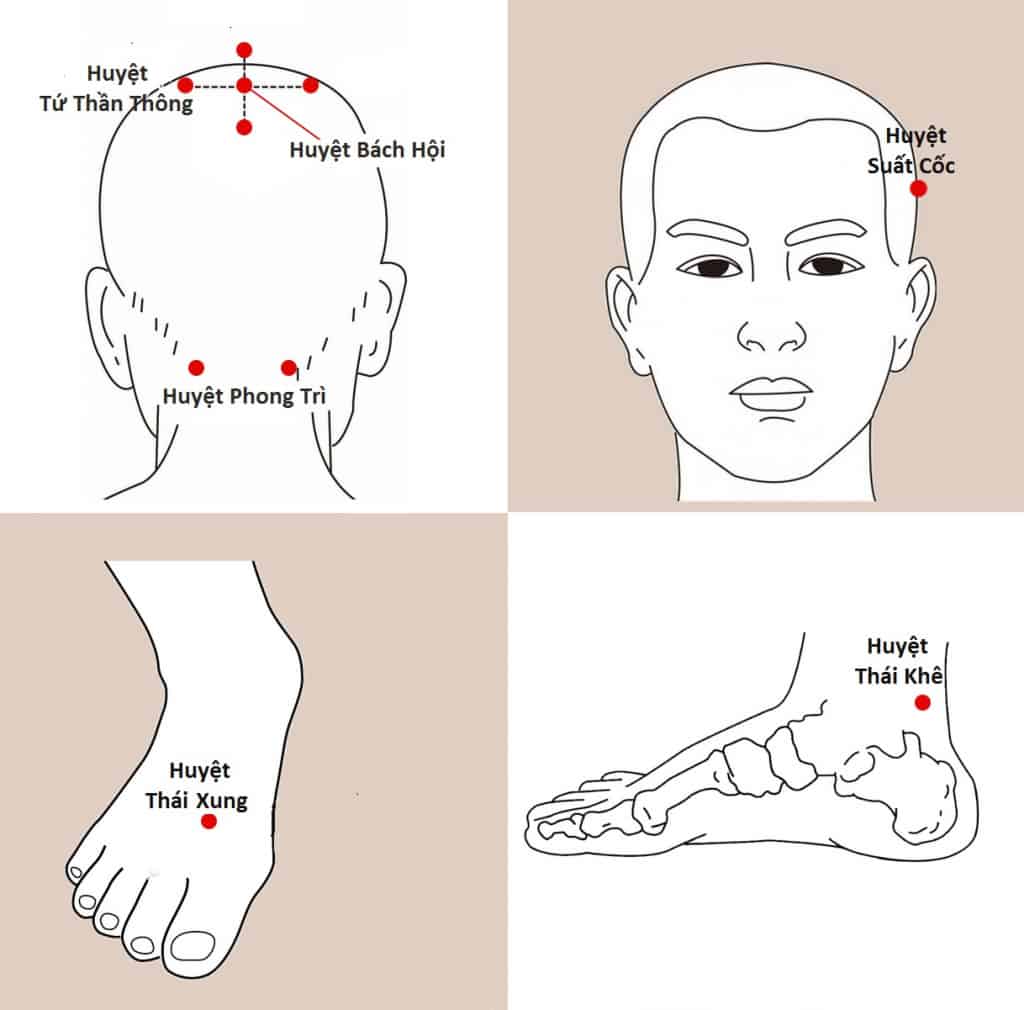 tóc bạc sớm