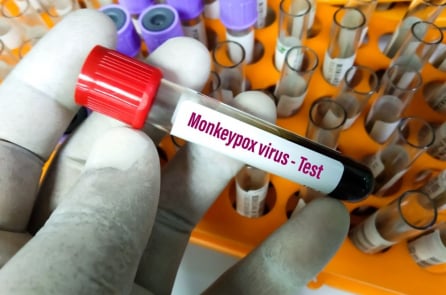 WHO dự kiến sẽ có thêm nhiều ca bệnh đậu mùa khỉ xuất hiện trên toàn cầu