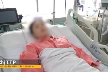 Một bệnh nhân tai biến thẩm mỹ được cứu sau 8 ngày can thiệp ECMO