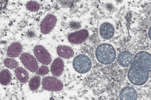 Truyền thông ĐCSTQ đổ nguồn gốc virus đậu mùa khỉ là do Mỹ