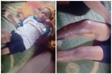 Đắk Lắk: Bé trai 8 tuổi mồ côi cha mẹ bị nam thanh niên tẩm xăng đốt