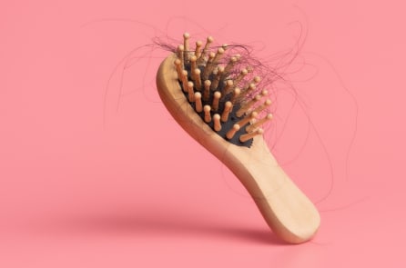 Phát hiện mới điều trị rụng tóc: SCUBE3 kích thích tóc nhân lên và phát triển