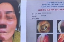Việt Nam công bố 3 ca hoại tử xương hàm do nhiễm nấm đen Mucormycosis