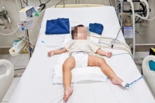 Dấu vết nghi bạo hành trên cơ thể bé gái 18 tháng tuổi ở Hà Nội