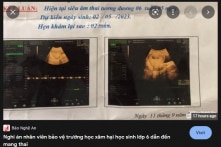 Nghệ An: Bé gái lớp 6 mang thai, nghi do bị bảo vệ trường xâm hại