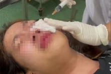 Hải Phòng: Truy tố người xịt hơi cay khiến nữ sinh 15 tuổi bị bỏng, rối loạn tâm lý
