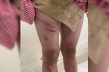 Hải Phòng: Bé trai 7 tuổi bị ‘bố dượng’ đánh thâm tím mặt, rớm máu trên thân