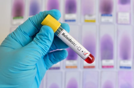 Bệnh Melioidosis (Whitmore) bùng phát ở Hồng Kông, 7 ca tử vong