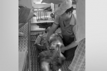 Cà Mau: Cấp cứu khẩn cho ngư dân gặp nạn bị mất chân trên biển