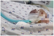 Vụ bạo hành bé 6 tháng tuổi: Bé bị đánh vào đầu nhiều lần, thương tích 99%, nguy kịch