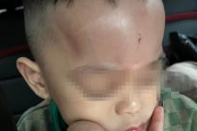 Đà Nẵng: Công an điều tra vụ trẻ nghi bị bạo hành, 2 GV mầm non bị tạm đình chỉ