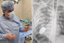 Ukraine: Thành công mổ lấy lựu đạn chưa nổ ra khỏi ngực người lính