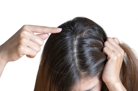 Có nên nhổ tóc bạc hay không?