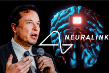 Công ty cấy chip não Neuralink của Elon Musk được định giá tăng vọt