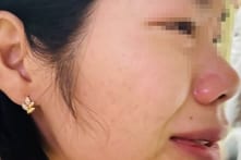 Vụ thầy giáo đánh cô giáo của con: Công an phạt 6,5 triệu đồng