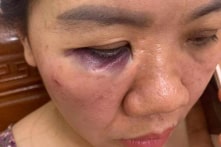 Hà Tĩnh: Nam công nhân điện lực đánh nữ đồng nghiệp thương tích phải nhập viện