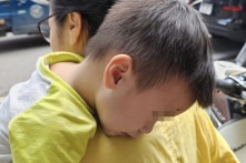 Bé trai 2 tuổi bị hoại tử mắt sau khi bóc giả mạc: Các bác sĩ cố giữ con mắt cho bé