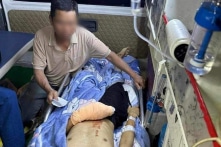 Nam sinh bị dập nát bàn tay và tổn thương mắt nghiêm trọng sau tiếng nổ tại nhà