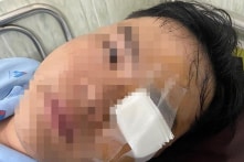 TP.HCM: Nam thanh niên ‘tố’ bị cảnh sát giao thông dùng gậy đánh vào mắt phải cấp cứu
