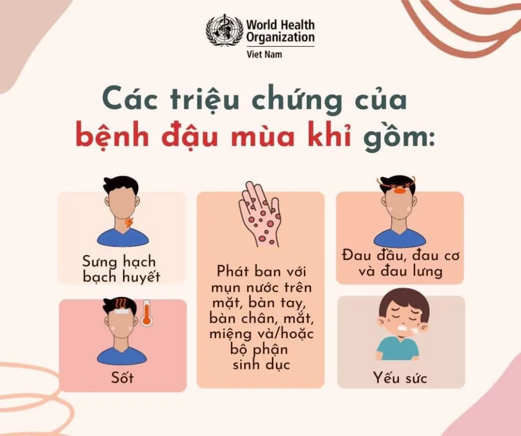 trieu chung benh dau mua khi