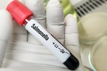 Vụ trẻ ngộ độc sau tiệc Trung thu: Phát hiện có vi khuẩn Salmonella