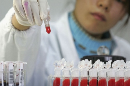 Dịch AIDS ở Trung Quốc đáng sợ hơn những gì được công bố