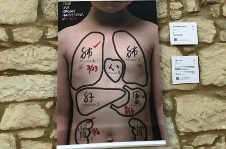 Chu Hiểu Huy: Công an xác nhận vụ học sinh mất tích liên quan đến thu hoạch tạng