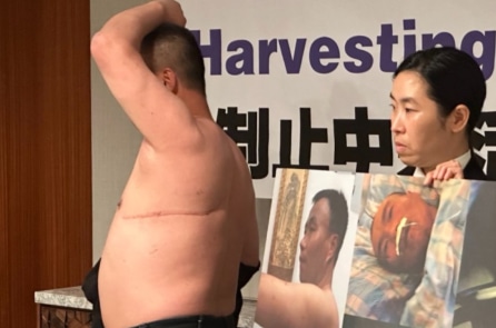 ĐCSTQ tự phơi bày chính mình khi phủ định chuyện thu hoạch nội tạng ông Trình Bội Minh