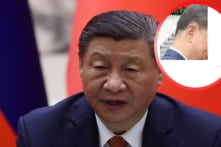 Bức ảnh chụp Tập Cận Bình làm dấy lên nghi ngờ ông đã phẫu thuật sọ