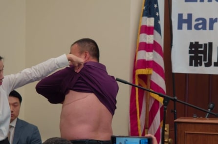 Nạn nhân sống sót sau khi bị thu hoạch nội tạng tiếp tục tố cáo ĐCSTQ