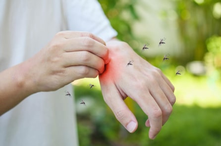 Bác sĩ khuyên: Đừng làm điều này sau khi bị muỗi đốt