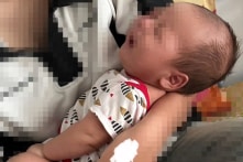 Bé gái 3 tháng tuổi bầm tím mặt, bụng, nghi bị bạo hành