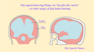 Mot nguoi Phap co nuoc trong Nao 1