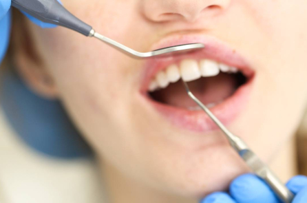 Răng giả hay cấy ghép: Loại nào phù hợp với bạn?