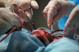 Hiến tạng được ca ngợi là nhân đạo nhưng cơ hội sống lại không thuộc về số đông