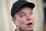 Tỷ phú Elon Musk hé lộ lý do bị bầm mắt