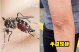 Một nửa Trung Quốc thành khu vực rủi ro lây nhiễm sốt Chikungunya